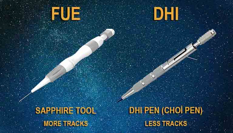 DIFFERENCES BETWEEN FUE & DHI
